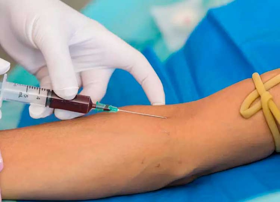 Exame PSA é feito com base na coleta de sangue de pacientes — Foto: Prefeitura de Assis/Divulgação
