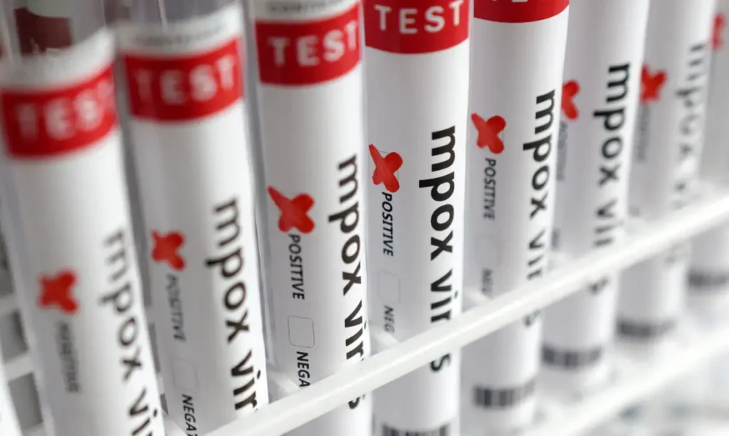 Test tubes labelled