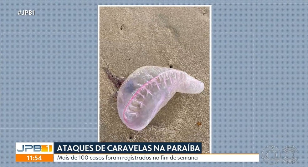 Mais de 100 queimaduras registradas por animais marinhos em João Pessoa no último fim de semana — Foto: Reprodução / TV Cabo Branco