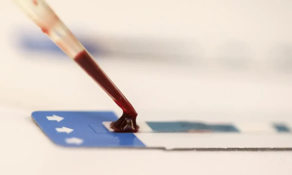 Teste de HIV
