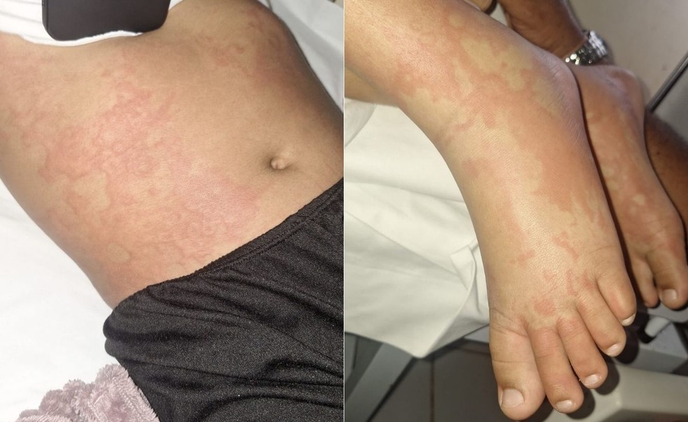 Menina está internada e, segundo família, foi diagnosticada com infecção bacteriana — Foto: Reprodução