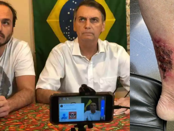 Carlos afirmou na publicação que o ferimento na perna de Bolsonaro já estava em processo de recuperação. — Foto: Reprodução