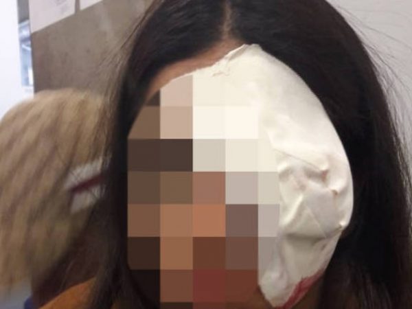 Em nota, o hospital em que a adolescente foi atendida diz que ela sofreu "um trauma muito grande" no olho atingido — Foto: Reprodução