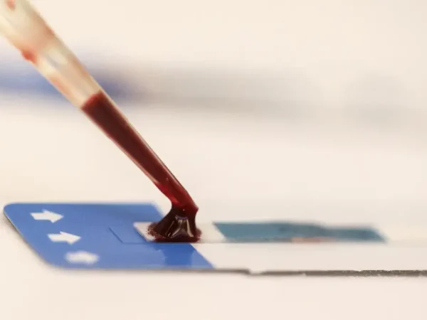 Teste de HIV