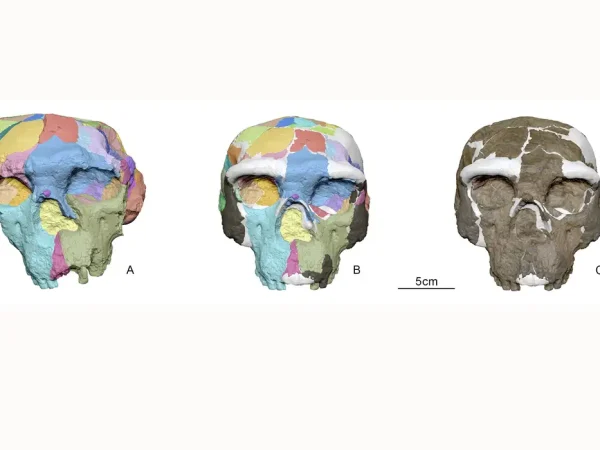 Crânio humano descoberto da China. The digital reconstruction process used on an archaic human skull, called Yunxian 2, that was unearthed in 1990 in China's Hubei Province, is shown in this image released on September 25, 2025. Figure A shows the skull, with certain areas marked in different colors, with the deformation caused by the fossilization process. Figure B shows the skull, with those same areas marked in the same colors as in Figure A, after scientists used advanced CT scanning, structured light imaging and sophisticated virtual reconstruction techniques to digitally reconstruct the skull. Figure C shows the digitally reconstructed skull, with missing pieces marked in white. Xijun Ni/Handout via REUTERS    THIS IMAGE HAS BEEN SUPPLIED BY A THIRD PARTY NO RESALES. NO ARCHIVES.