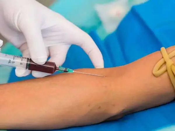 Exame PSA é feito com base na coleta de sangue de pacientes — Foto: Prefeitura de Assis/Divulgação