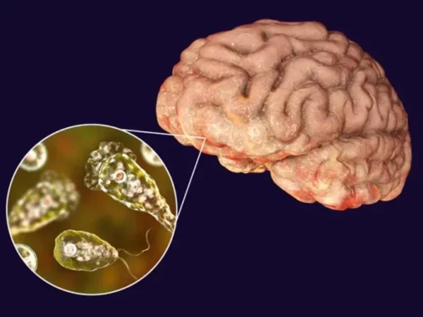 A ameba “comedora de cérebro” provoca uma doença chamada de meningoencefalite amebiana primária (PAM). — Foto: Reprodução