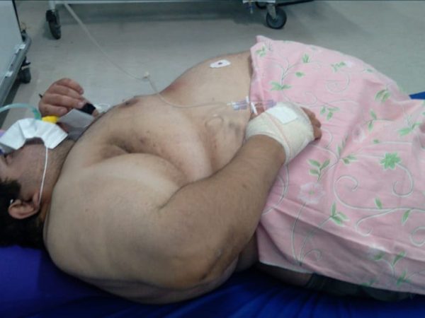 Carlos Alberto Félix da Silva estava internado no Hospital Regional de João Câmara desde segunda-feira (23) — Foto: Cedida