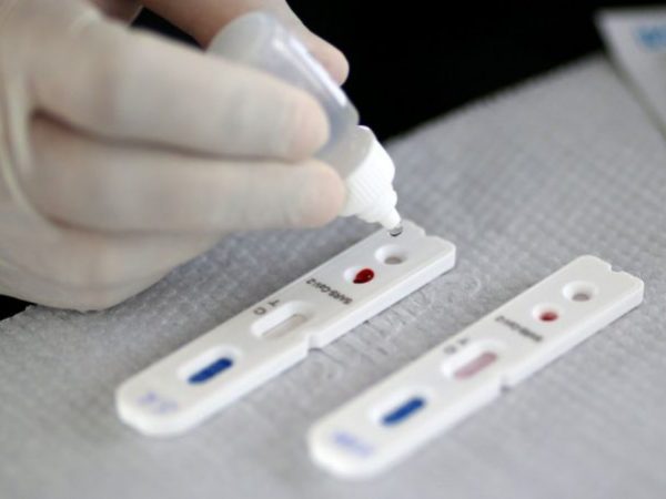 Testagem do tipo RT-PCR, que é feita por análise molecular, passa a ser ofertada para as pessoas que apresentarem síndrome gripal do primeiro até o sétimo dia do início dos sintomas no Estado — Foto: Reprodução