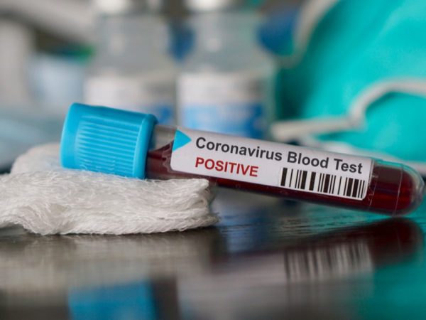 Estado de Alagoas confirmou a primeira morte pelo novo coronavírus (Sars-Cov-2) — Foto: © Shutterstock