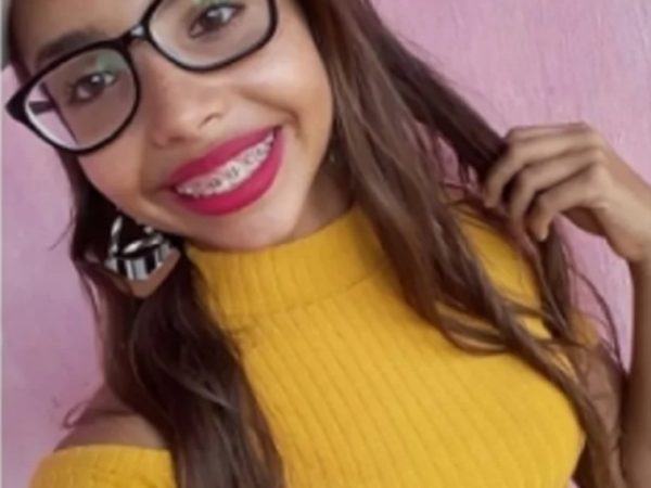 Emanuela Medeiros, aluna da Escola Antônio Fagundes, em Mossoró, sofreu uma queda quando brincava com colegas — Foto: Arquivo Familiar