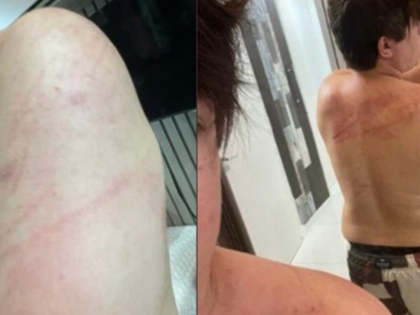 DJ Ivis Araújo aparece ferido com arranhões em fotos — Foto: Reprodução/Redes sociais