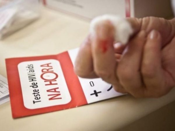 Teste de HIV (Foto: Agência Brasil)