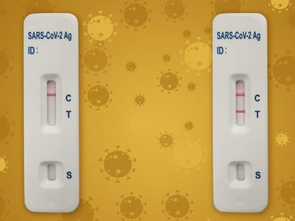 Quem for fazer o teste de RT-PCR, deve, também, portar a solicitação médica. — Foto: Reprodução