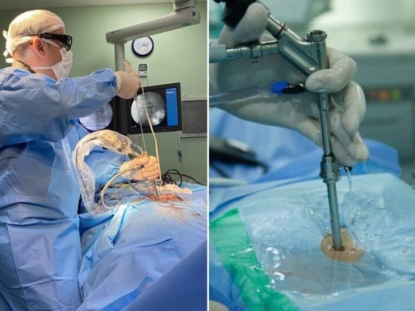 Dr. Márcio Ramalho é um dos raros especialistas que realiza procedimento no mundo — Fotos: Cedidas