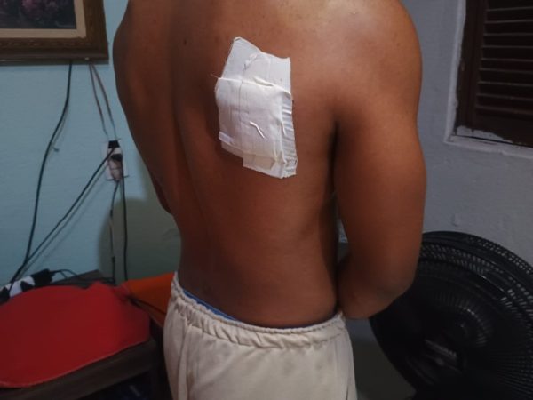 Estudante foi baleado por policial à paisana — Foto: Ewerton Correia/TV Cabo Branco