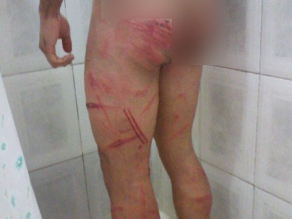 Soldado ficou com marcas no corpo após agressões (Foto: Arquivo Pessoal)