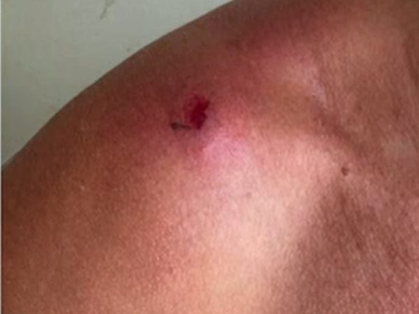 Mulher agredida no trânsito nesta quinta-feira (30) — Foto: Divulgação