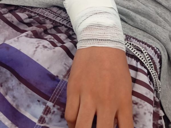 Jovem de 15 anos é atacado por pitbull em João Pessoa — Foto: Reprodução / TV Cabo Branco