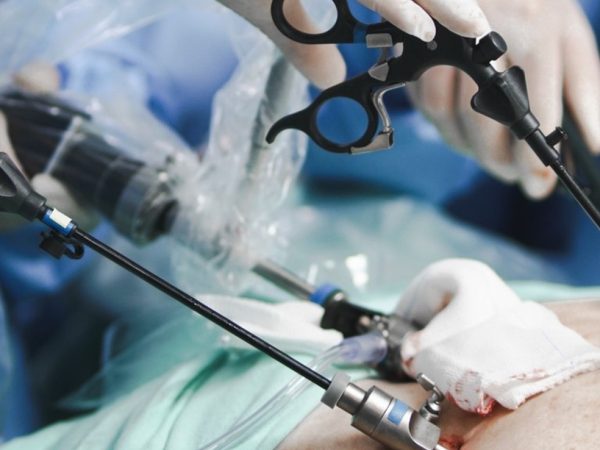 Paraíba é estado com maior número de cirurgias bariátricas realizadas pelo SUS no Nordeste — Foto: Governo da Paraíba/Divulgação