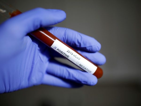 Foto ilustrativa mostra resultado positivo para o novo coronavírus — Foto: Dado Ruvic/Reuters/Arquivo