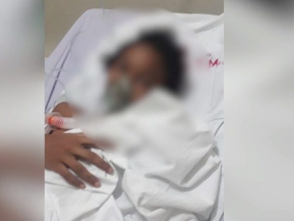 Criança foi levada ao Hospital Regional Tarcísio Maia, mas não corre risco de morrer e deve receber alta nesta quarta-feira (17) — Foto: Cedida