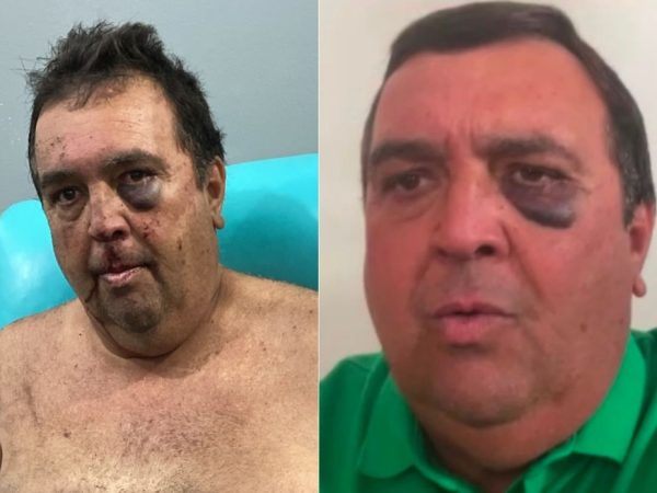 Vereador é agredido e amarrado em sequestro relâmpago no interior do RN — Foto: Cedida