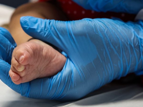 São Paulo (SP), 28/02/2025 - Mês das Doenças Raras. Crianças com doenças raras no hospital Municipal Infantil Menino Jesus. Foto: Paulo Pinto/Agência Brasil