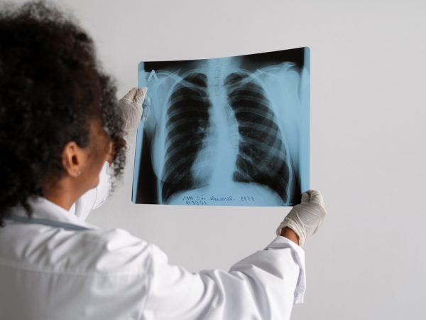 Tabagismo é o maior fator de risco - Câncer também atinge não fumantes. — Foto: Freepik