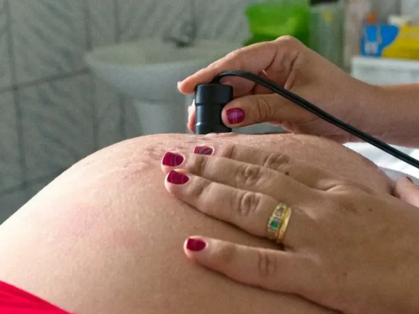 Referentes ao período de 2006 a 2015, os dados tornam o Brasil o sétimo da América do Sul no quesito taxa de gravidez adolescente