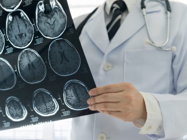 Médico segurando tomografia