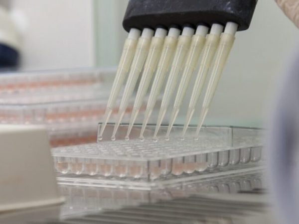 Laboratórios públicos deverão produzir insumos para medicamentos contra doenças como tuberculose e hanseníase Viktor Braga/UFC