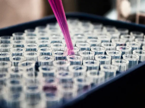 Teste de sangue pode revolucionar diagnóstico da doença de Alzheimer. Foto: Louis Reed/ Unsplash