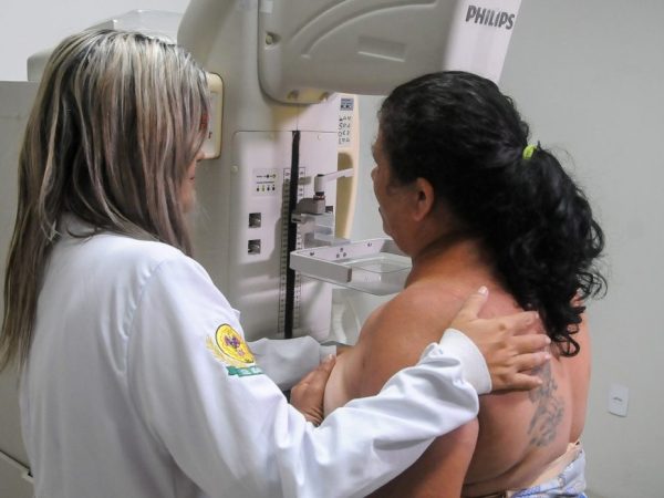 A mamografia é o principal exame de detecção precoce do câncer de mama. — Foto: Marco Antônio/ Secom Maceió