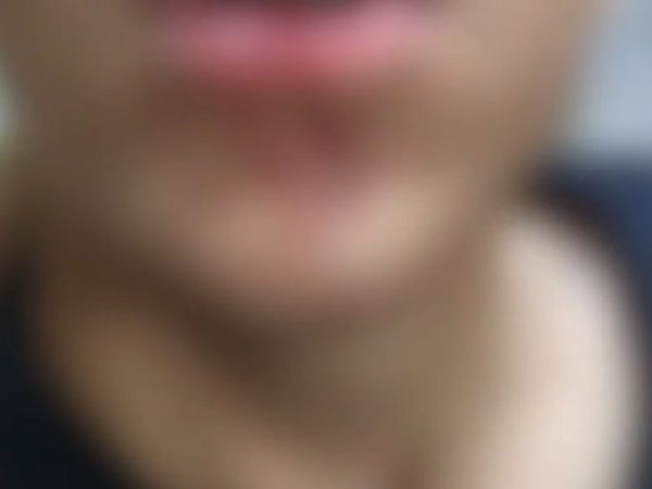 Rosto com sangue de um dos adolescentes que denunciaram agressão do PRF em Mossoró — Foto: Reproduação/Inter TV Cabugi