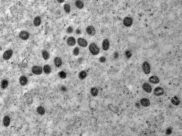 A varíola dos macacos é transmitida pelo vírus monkeypox, que pertence ao gênero orthopoxvirus. — Foto: Reprodução