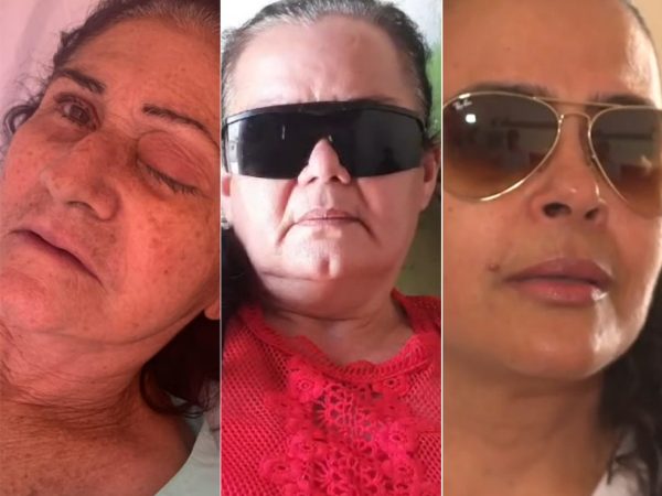 Pacientes que tiveram infecção após cirurgia: Maria Izabel (esquerda), Rita de Cássia (centro) e Vitória Dantas (direita) — Foto: Divulgação