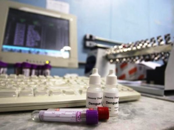 Testes passarão a ser oferecidos no Sistema Único de Saúde - (Agência Brasil)