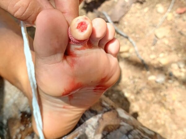 Banhistas são atacados por piranhas em rio no interior do RN — Foto: Cedida