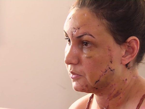 Estudante Pollyana Cristine Carvalho, 32 anos, diz que foi agredida por namorado em motel Goiânia Goiás (Foto: TV Anhanguera/Reprodução)