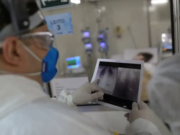 O chefe do médico da UTI, Everton Padilha Gomes, examina uma radiografia de tórax de um paciente em um hospital de campo criado para tratar pacientes que sofrem da doença por coronavírus (COVID-19) em Guarulhos, São Paulo
