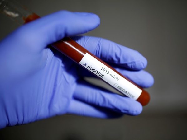 Foto ilustrativa mostra resultado positivo para o novo coronavírus — Foto: Dado Ruvic/Reuters/Arquivo