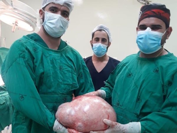 Tumor de quase 20 quilos é retirado do ovário de paciente em Cruzeiro do Sul — Foto: Arquivo pessoal